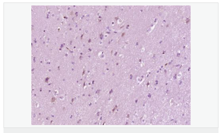 6058511e823cd.png image.png