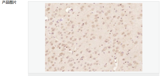 60595a5473b38.png image.png