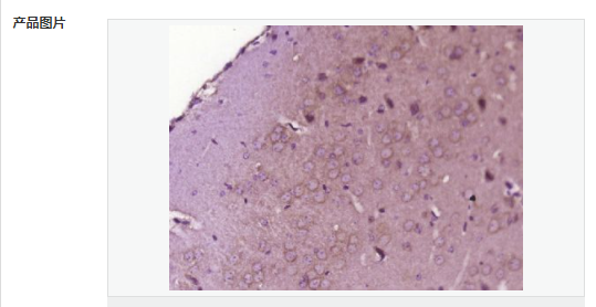 6066d57a7f7f2.png image.png